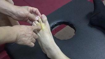 德国产妇针灸治疗视频,缓解分娩疼痛新选择